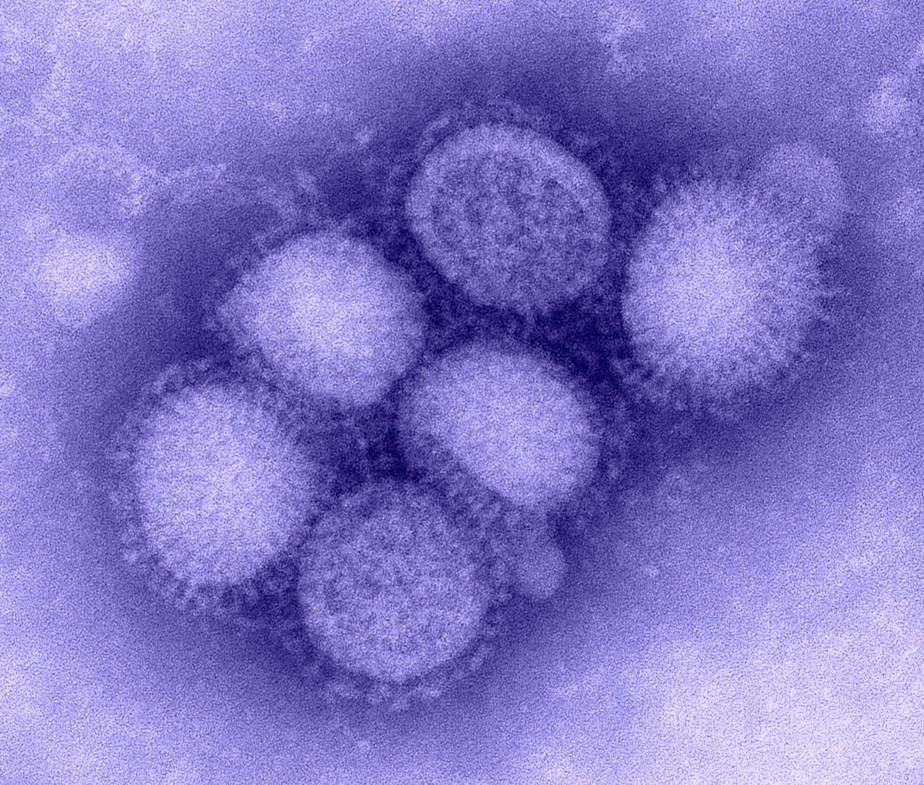 H1N1_influenza_virus-e1486501526309.jpg