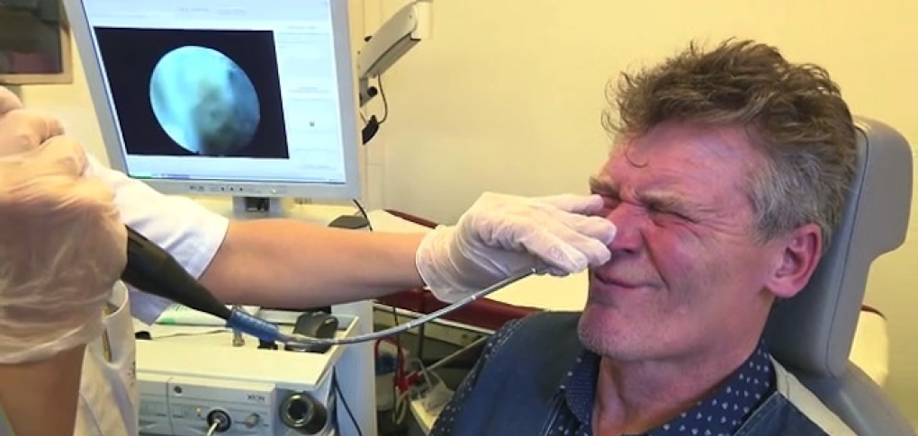 Nasal 2.jpg