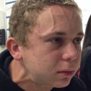 strain.jpg
