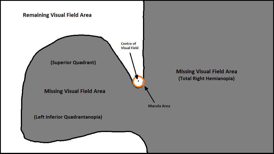 Visual Field Diagram - Bordered.png